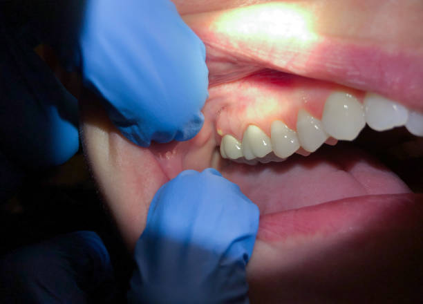 Best Broken Tooth Emergency  in Speer, NC